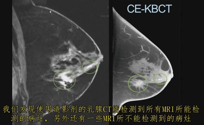 KBCT產(chǎn)品優(yōu)勢(shì)6