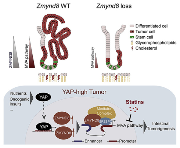 YAP-ZMYND8-MVA信號(hào)軸在腸道干細(xì)胞穩(wěn)態(tài)及惡性轉(zhuǎn)化中的作用機(jī)制